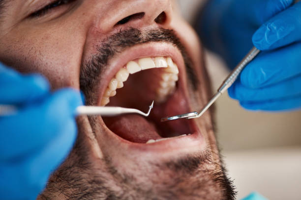 Best Emergency Treatment for Oral Infections in Magnolia, OH